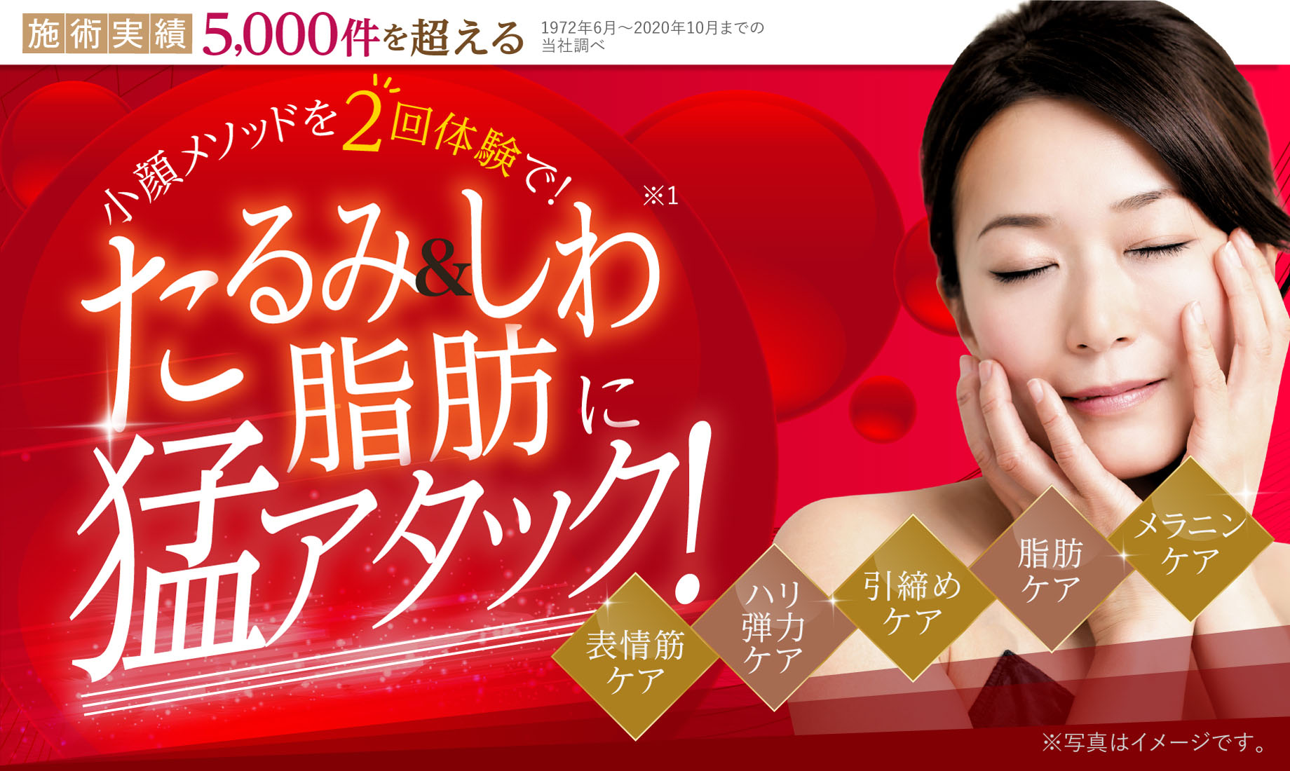 形状記憶小顔エステ