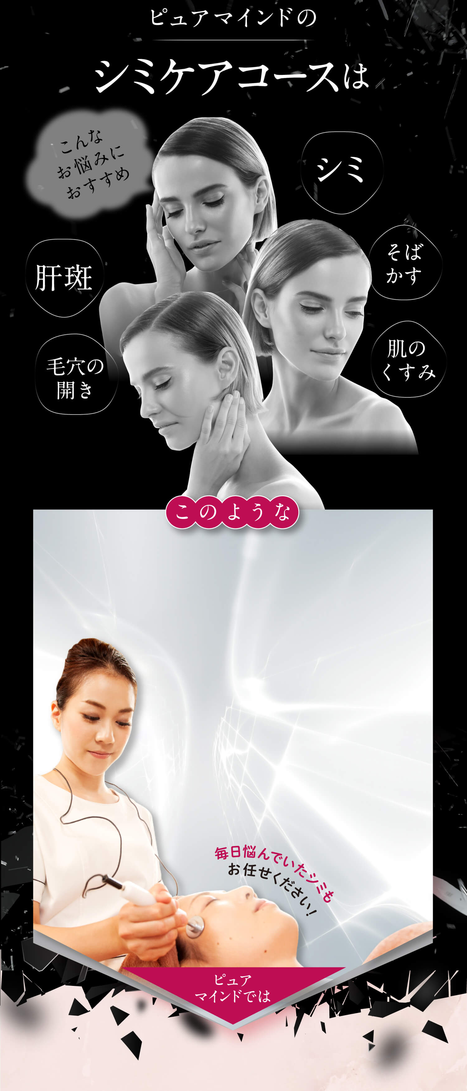 ピュアマインドのこんなお悩みにおすすめ肝斑毛穴の開きシミそばかす肌のくすみ このような毎日悩んでいたシミもお任せください！ピュアマインドでは